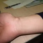 Hydroma какво е Hydroma какво е