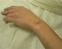 Hydroma какво е