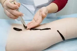 Как да пиявица у дома