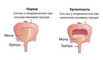 Какво е спешността