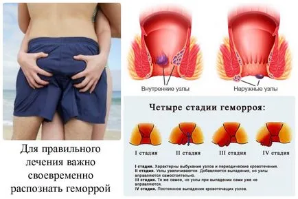 Сърбеж в ануса като лакомство Сърбеж в ануса като лакомство