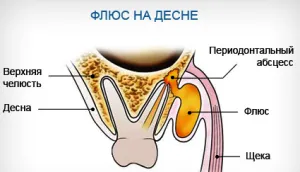 поток на лечение у дома