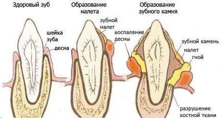 Както е оформен зъб