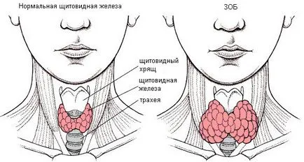 Увеличени симптоми на щитовидната жлеза