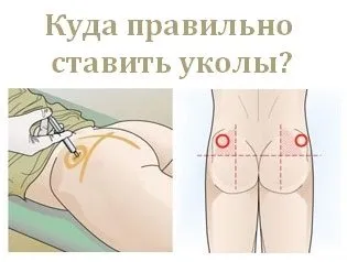 Както се прилагат инжекции
