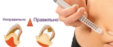 Както се прилагат инжекции