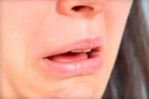 Защо не мога да ям кисело Защо не мога да ям кисело