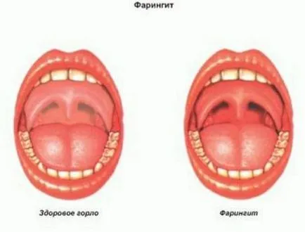 гърлото на детето да се направи червено