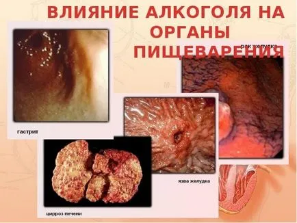 Как за лечение на черния дроб, след употреба на алкохол
