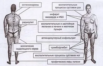 Как да пиявица у дома