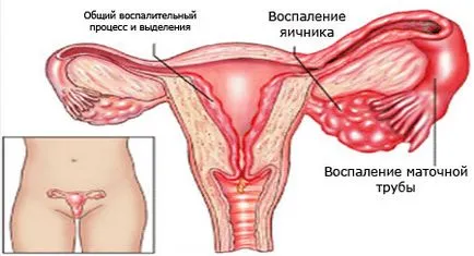 Защо може да забави менструация Защо може да забави менструация