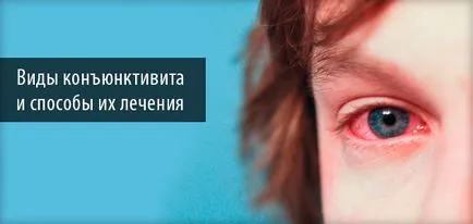 Than за лечение на конюнктивит лечение с лекарства и народни средства за защита (при възрастни, бременни жени и деца) (средства) Than за лечение на конюнктивит лечение с лекарства и народни средства за защита (при възрастни, бременни жени и деца)