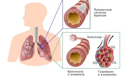 Хърт бронхи причини, симптоми и лечение