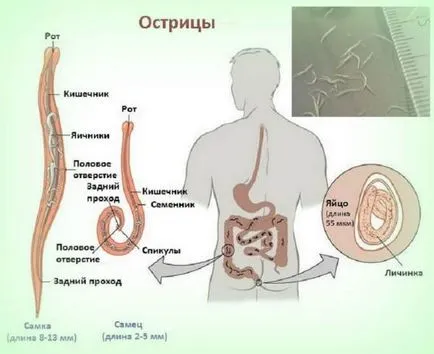 Симптомите, които имат червеи Симптомите, които имат червеи