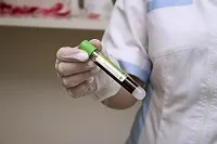 Какво е антитяло на вируса