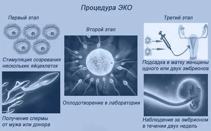 Как да започнете еко
