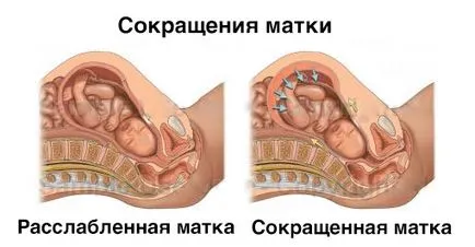 Как да се намали на матката