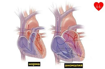Как да се намери сърцето на