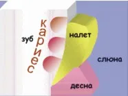 Както е оформен зъб