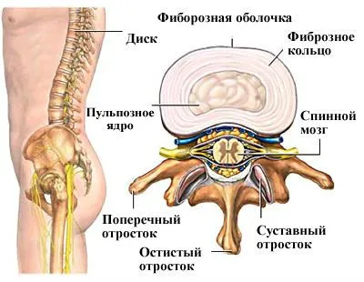 Какво е спинална стеноза