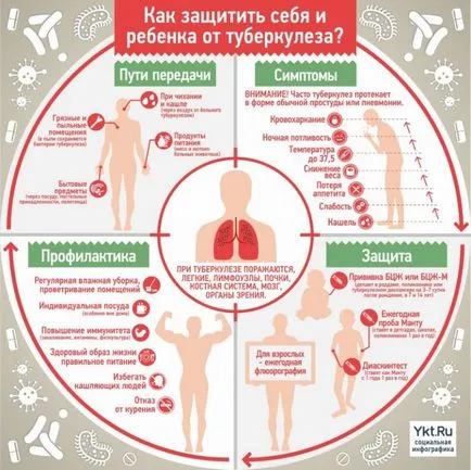 лечение на туберкулоза у дома