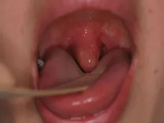 Tongue го