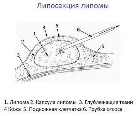 От този талк на главата му