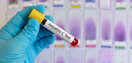 тест Hcv кръв какво е