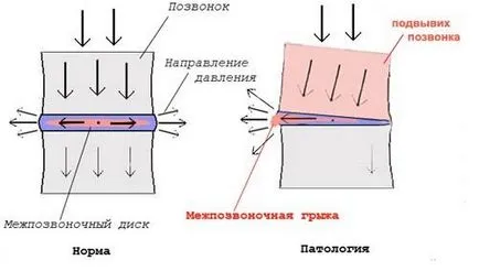 Херния ефекта й