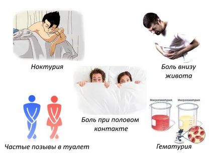 Цистит какво да правя
