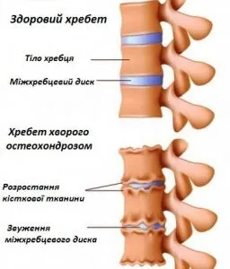 Какво е болки в кръста и причините за