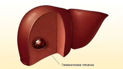 Какво е неприлично