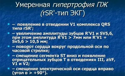 Лечение на хипертрофия на лявата камера на сърцето