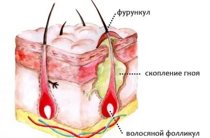 Как да се лекува възпалението себе си