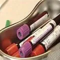 тест Hcv кръв какво е