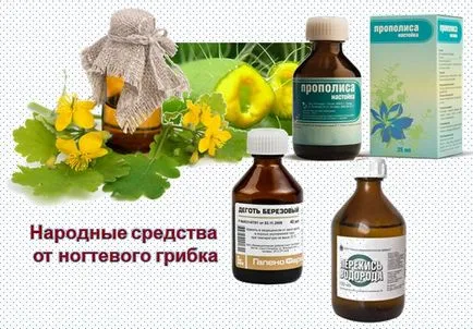 Какво може да лекува гъбички на ноктите
