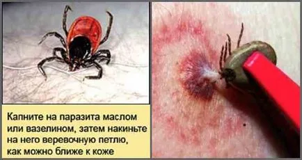 Как е енцефалит