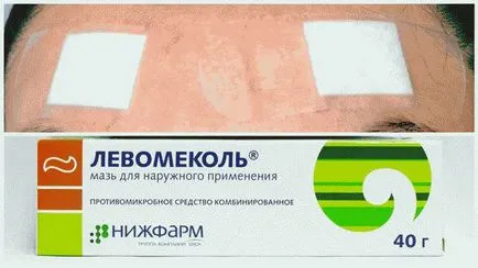 Как да се лекува възпалението себе си Как да се лекува възпалението себе си