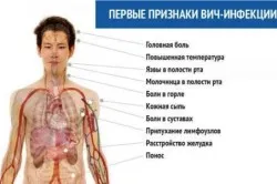 Какво трябва да направя, ако имам ХИВ