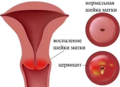 Как да си направим тампон у дома