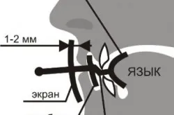 Хъркането е какво да правя