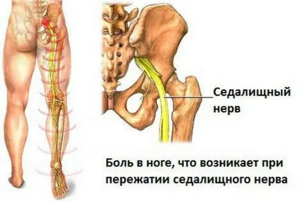 Как се третират нерви