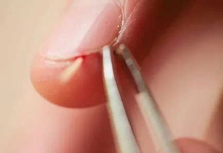 Как да премахнете много трън Как да премахнете много трън