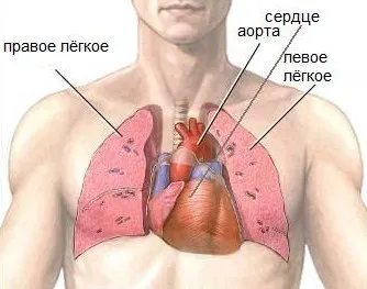 кардиомегалия го кардиомегалия го