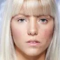 Сварете на лицето си как да се отнасяме и да се отърве от собствените си