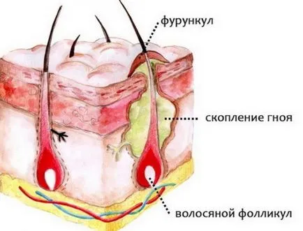 Сварете на лицето си как да се отнасяме и да се отърве от собствените си