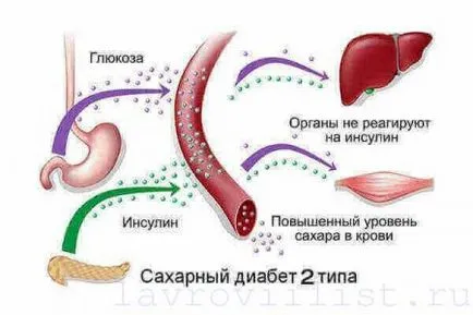 лечение диабет лавров