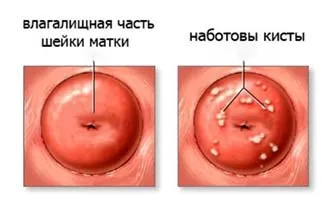 OV го naboti OV го naboti