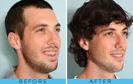 Захапка при възрастни процедури и цени, стоматология dentalsolution