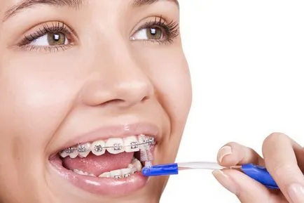 Захапка при възрастни процедури и цени, стоматология dentalsolution